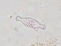 Navicula stesvicensis.